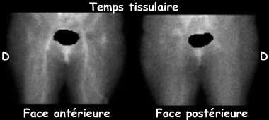 Temps tissulaire