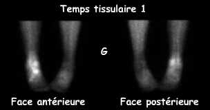 Temps tissulaire 1