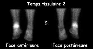 Temps tissulaire 2