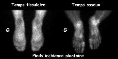 Temps tissulaire et temps osseux