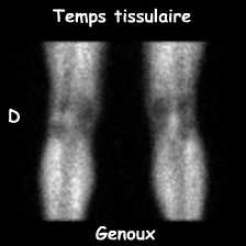 Temps tissulaire