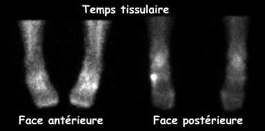 Temps tissulaire