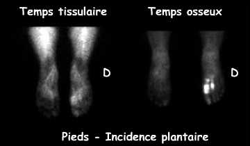 Temps tissulaire et temps osseux