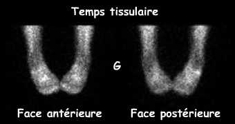 Temps tissulaire