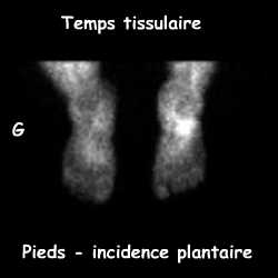 Temps tissulaire