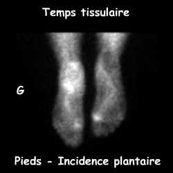 Temps tissulaire