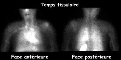 Temps tissulaire