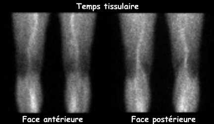 Temps tissulaire