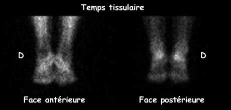 Temps tissulaire