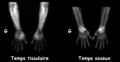 Temps tissulaire et temps osseux