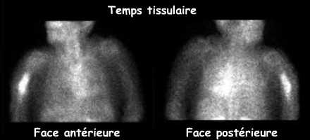 Temps tissulaire