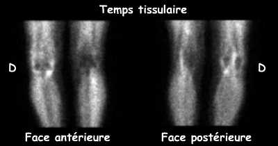 Temps tissulaire