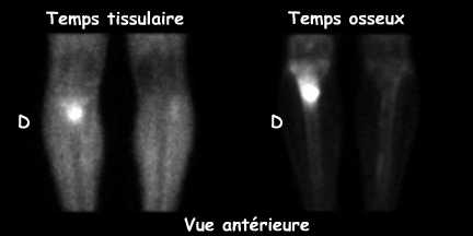 Temps tissulaire et temps osseux