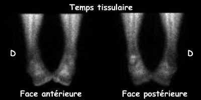 Temps tissulaire