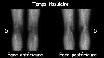 Temps tissulaire
