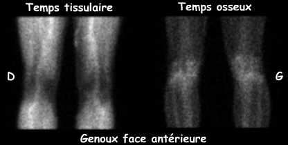 Temps tissulaire et temps osseux