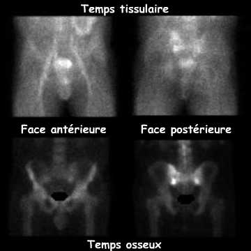 Temps tissulaire et temps osseux