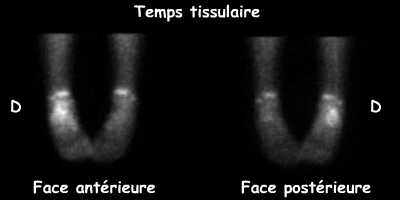 Temps tissulaire