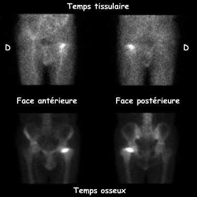Temps tissulaire et temps osseux