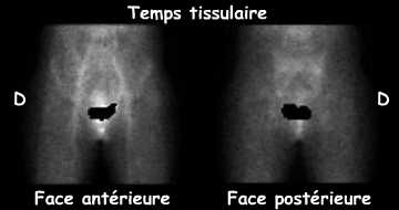 Temps tissulaire