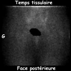 Temps tissulaire - Bassin