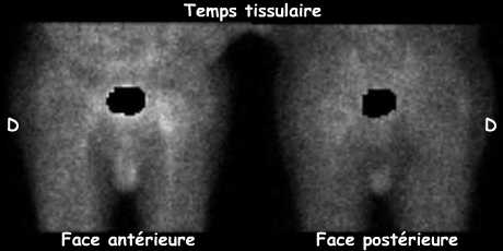 Temps tissulaire