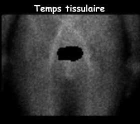 Temps tissulaire