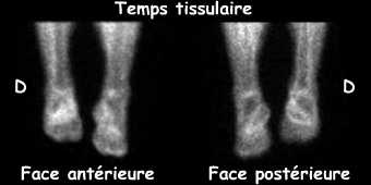 Temps tissulaire