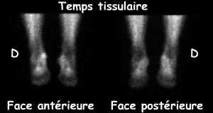 Temps tissulaire