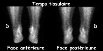 Temps tissulaire
