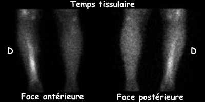 Temps tissulaire