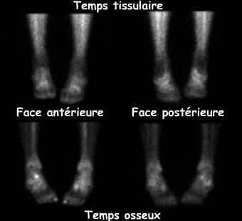 Temps tissulaire et temps osseux