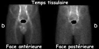 Temps tissulaire