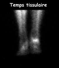 Temps tissulaire