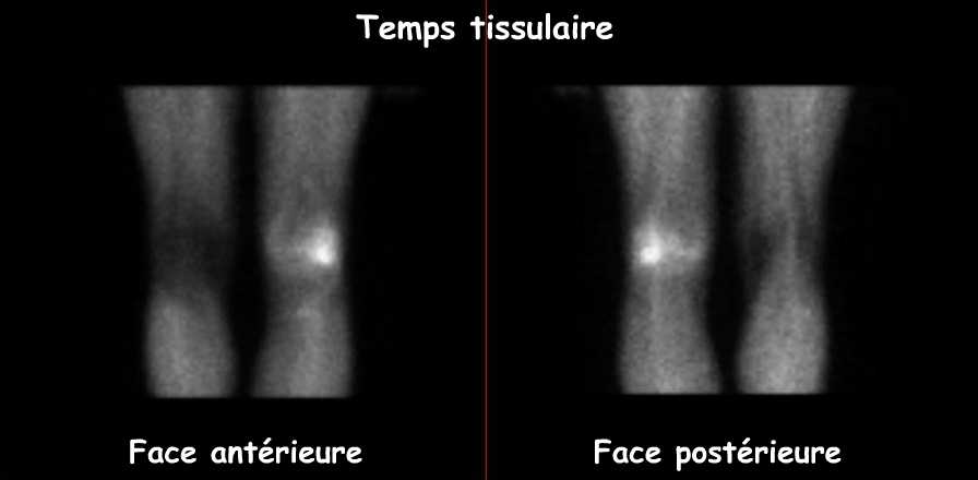 Temps tissulaire