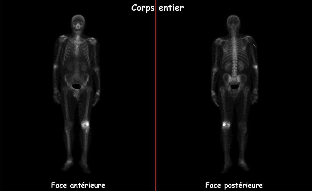Corps entier