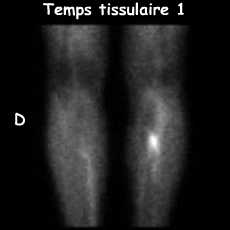 Temps tissulaire 1