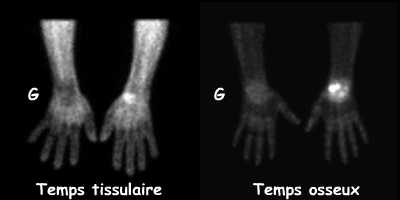 Temps tissulaire et temps osseux