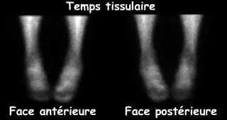 Temps tissulaire
