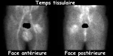 Temps tissulaire