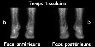 Temps tissulaire