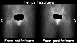 Temps tissulaire