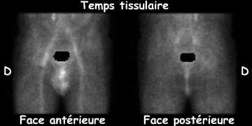Temps tissulaire