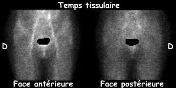 Temps tissulaire