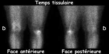 Temps tissulaire