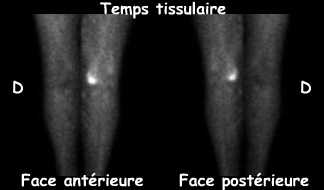 Temps tissulaire
