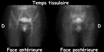 Temps tissulaire