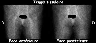 Temps tissulaire