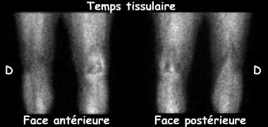 Temps tissulaire
