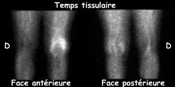 Temps tissulaire